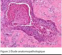 Figure 2 Étude anatomopathologique