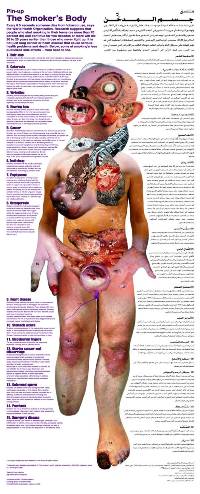 Image of the smoker’s body poster, showing all the diseases attributed to tobacco use, from head to toe. 