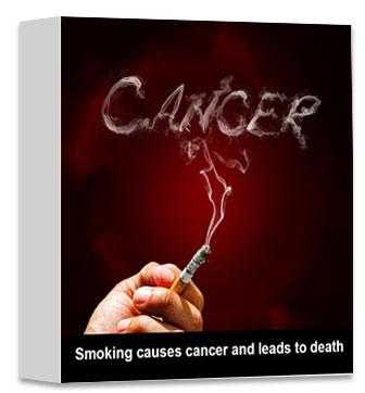 Smoking causes cancer and leads to death