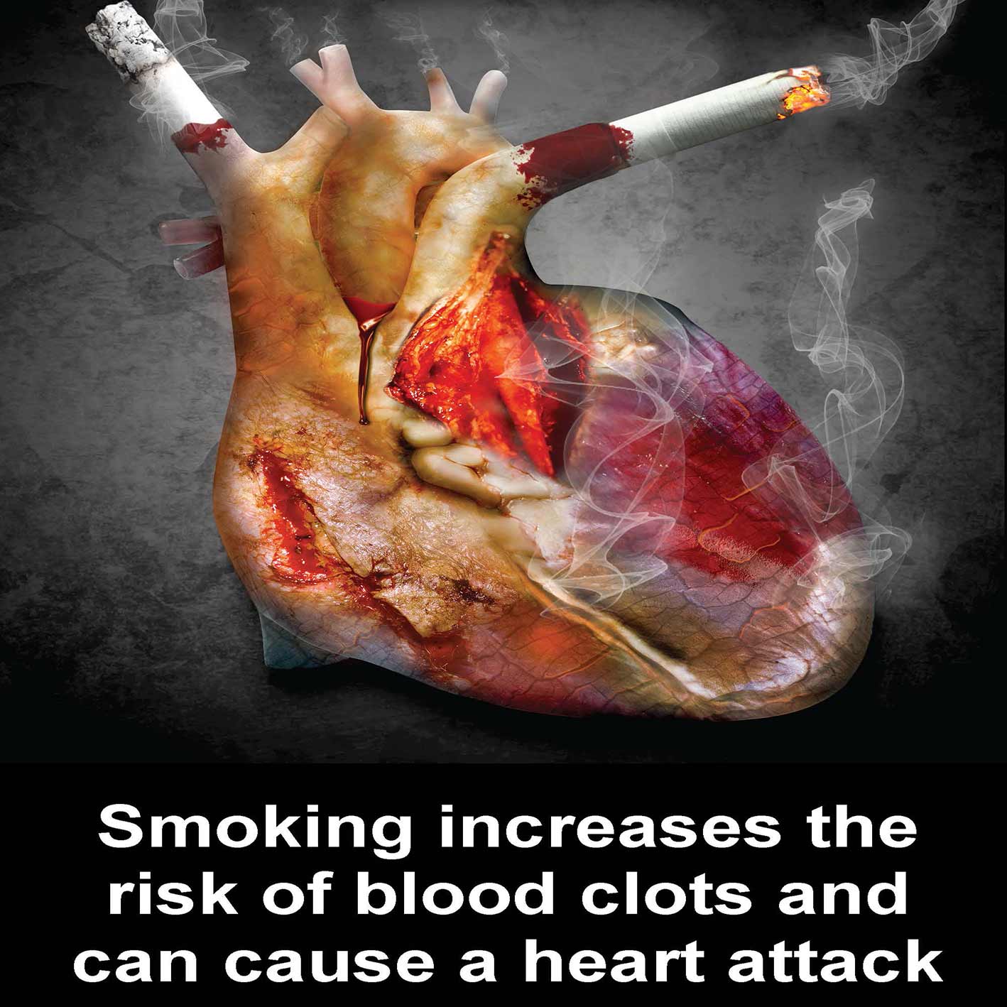 smoking-and-heart-disease