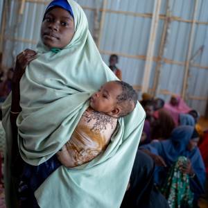 Somalia calls for help as 1.8 million Somali children under 5 experience acute malnutrition and health complications